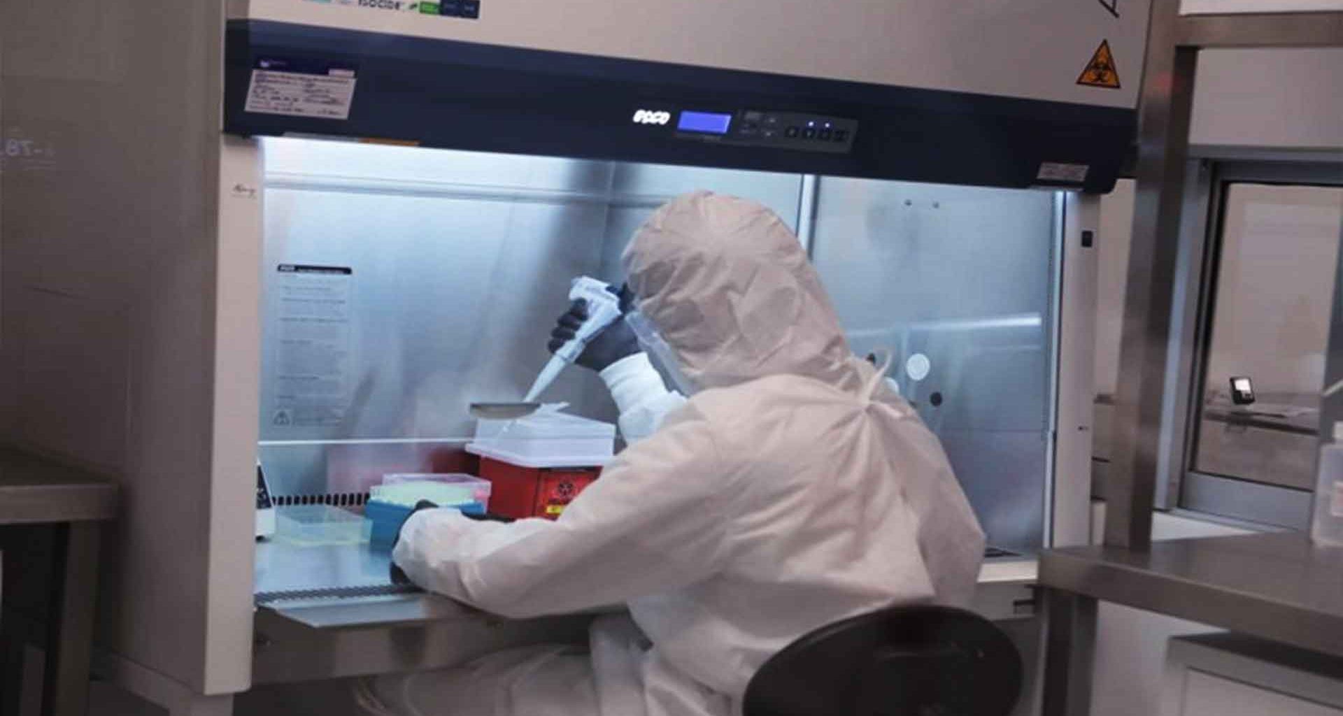 Cundinamarca realizará diagnóstico de viruela símica en el país