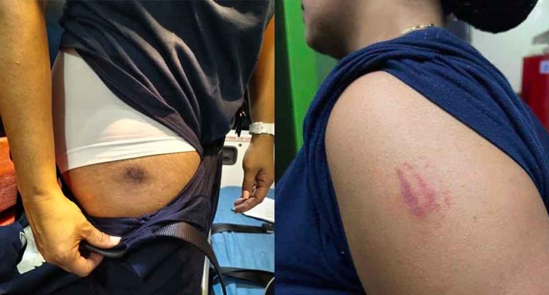 Bomberos de Fusagasugá agredidos durante atención de accidente vial