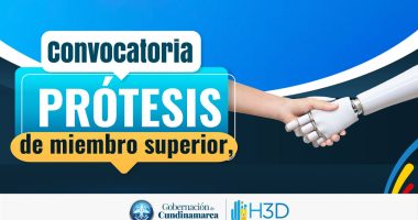 Cundinamarca avanza en la entrega de prótesis gratuitas a personas con discapacidad